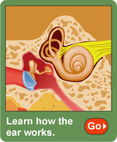 Hearing Loss