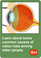 Vision Loss